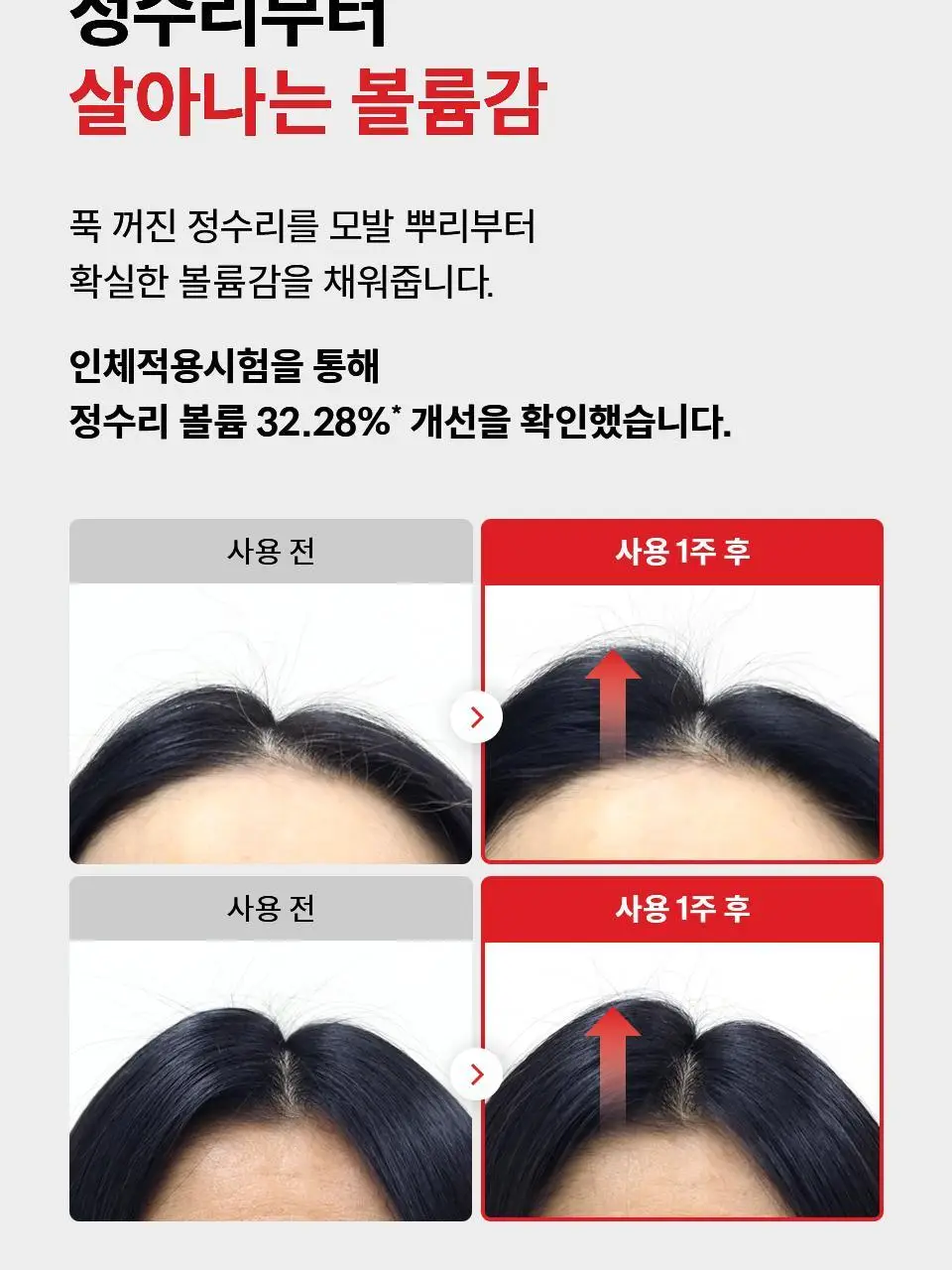 [포켓몬 에디션] 닥터포헤어 탈모완화앰플 50ml+스케일러 60g 기획 탈모케어 두피세럼 두피앰플 상세페이지 25